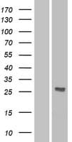 DKK2 Protein (Over-Expression Lysate Myc-DDK (Flag))