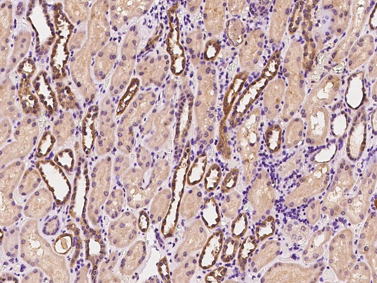 FNDC4 Antibody