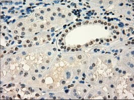 Monoclonal Mouse anti-Human FRK Antibody (clone OTI6D2, IHC, IF, WB)