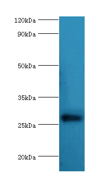 Polyclonal Rabbit anti-Human NAA10 / ARD1A Antibody (aa161-235, IHC, WB)
