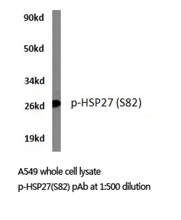 Polyclonal Rabbit anti-Human HSPB1 / HSP27 Antibody (phospho-Ser82, IHC, WB)