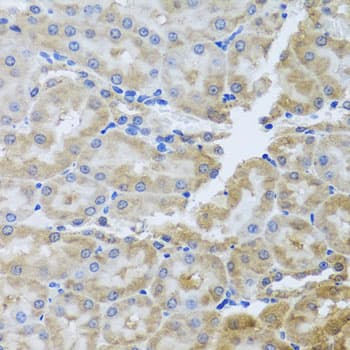 Polyclonal Rabbit anti-Human PER1 Antibody (IHC, WB)
