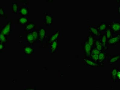 ASH2L / ASH2 Antibody (aa1-534)