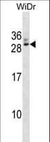 RAP30 / GTF2F2 Antibody (aa144-172)