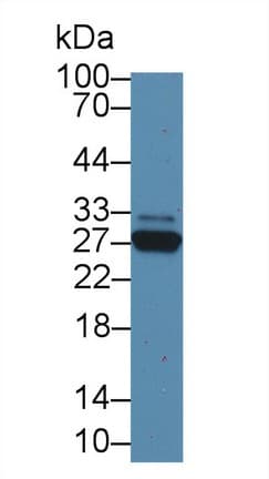 CRP / C-Reactive Protein Antibody (aa20-225)