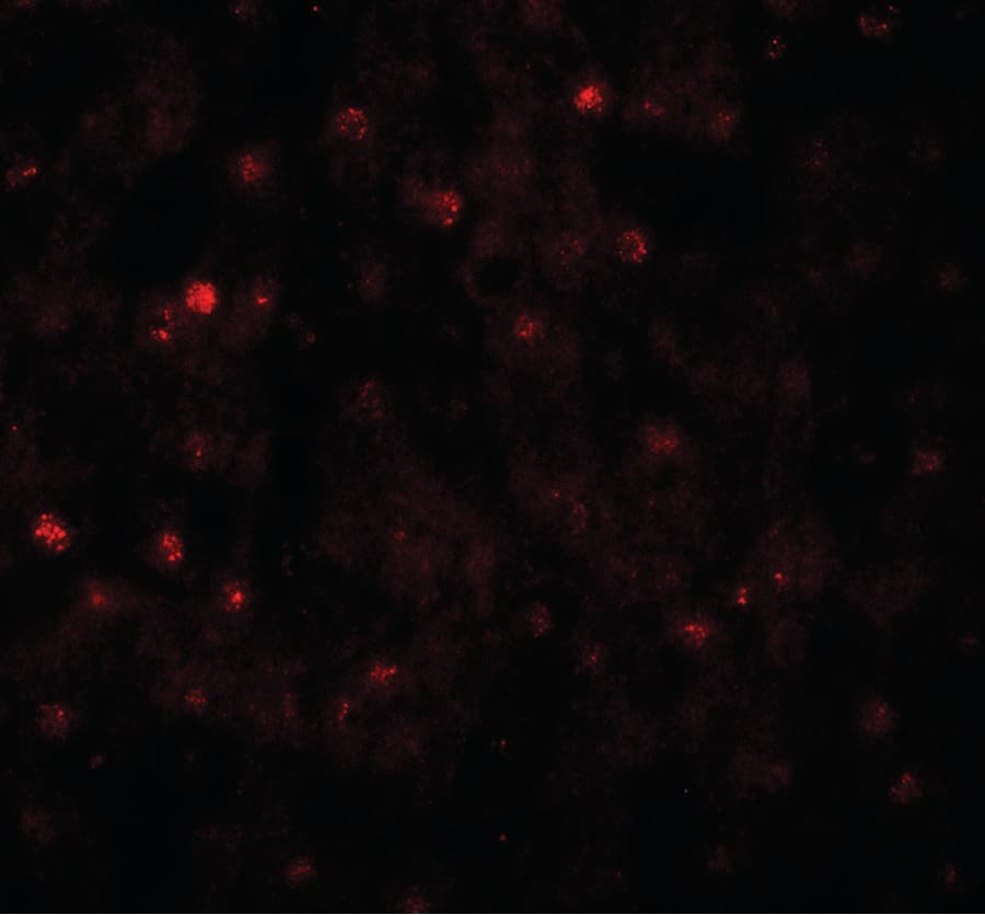 IHC-plus™ TCTEX1D4 Antibody