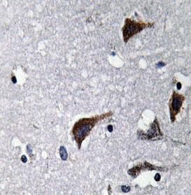 Polyclonal Rabbit anti-Human CTSB / Cathepsin B Antibody (aa200-270, IHC, IF, WB)