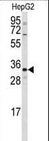 CTDSP2 Antibody (aa12-42)