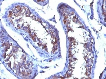 Testosterone Antibody (clone 4E1G2)