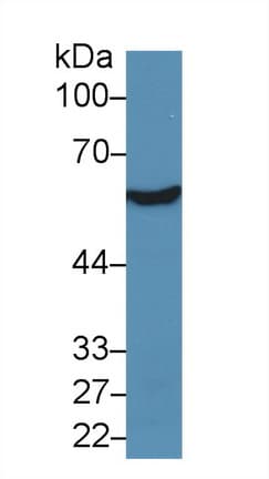 ALDH7A1 Antibody (aa1-539, PE)