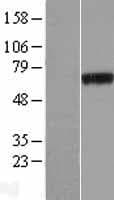 PHF19 Protein (Over-Expression Lysate Myc-DDK (Flag))