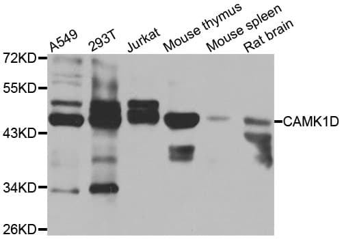 Polyclonal Rabbit anti-Human CAMK1D Antibody (IHC, IF, WB)