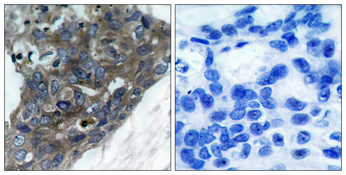 MAP3K5 / ASK1 Antibody (aa932-981)