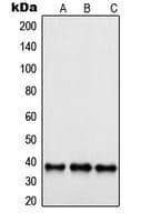 Polyclonal Rabbit anti-Human SAE1 Antibody (Internal, IHC, IF, WB)