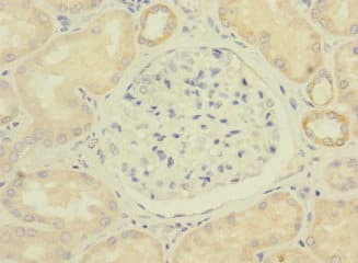 Polyclonal Rabbit anti-Human C11orf1 Antibody