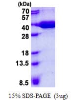 Human VBP1 Protein (Recombinant His)