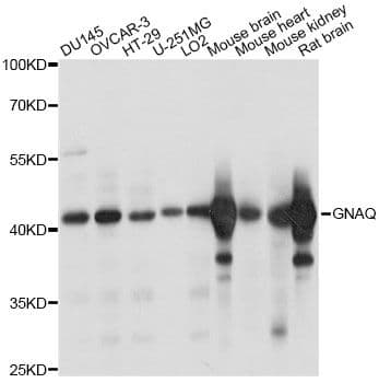 Polyclonal Rabbit anti-Human GNAQ Antibody (WB)