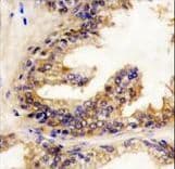 BRAF / B-Raf Antibody (aa424-453)