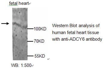 ADCY6 / Adenylate Cyclase 6 Antibody