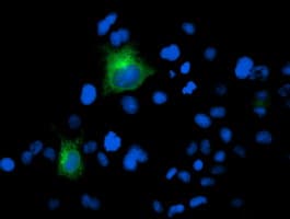 FOLH1 / PSMA Antibody (clone 3H5, Carrier-free)