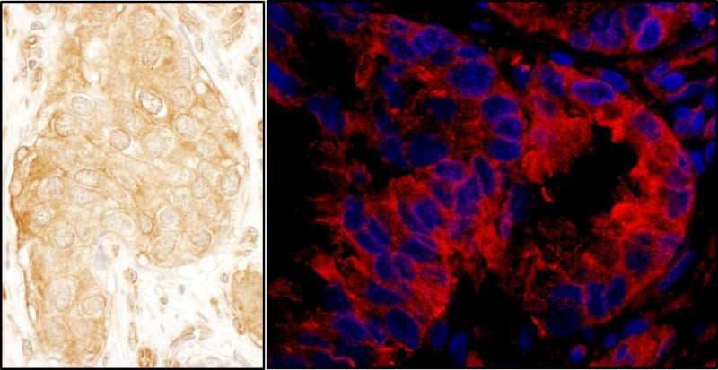 SASH1 Antibody (aa750-800)