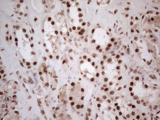 IRS1 Antibody (aa1-280, clone OTI3G10)