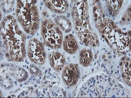 Monoclonal Mouse anti-Human CMPK / CMPK1 Antibody (clone OTI2B2, IHC, IF, WB)
