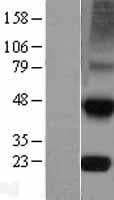 Human TIMP4 Protein (Over-Expression Lysate Myc-DDK (Flag))