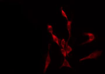 Polyclonal Rabbit anti-Human STK11 / LKB1 Antibody (phospho-Ser428, IHC, IF, WB)