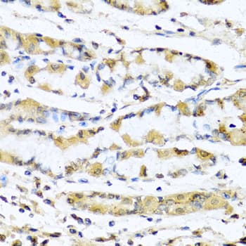 GNRH Antibody