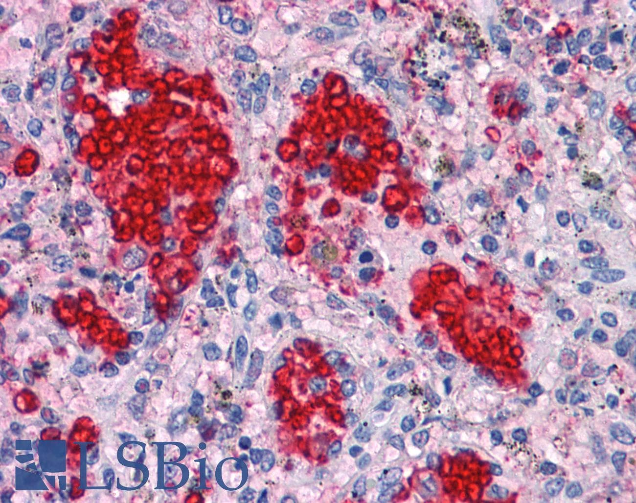 IHC-plus™ NKX3-1 Antibody (clone 4H4)