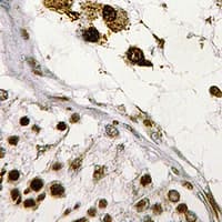 ASF1B Antibody (Internal)