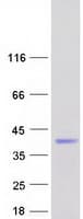 Human ZCCHC17 / PNO40 / PS1D Protein (Recombinant Myc-DDK (Flag))