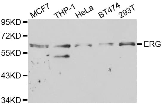 Polyclonal Rabbit anti-Human ERG Antibody (IHC, IF, WB)