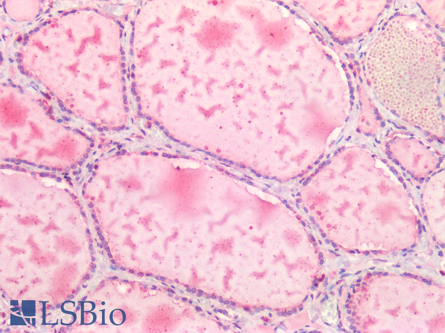 IHC-plus™ Polyclonal Rabbit anti-Human ALK2 / ACVR1 Antibody (IHC)