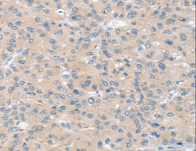 SLIT2 Antibody