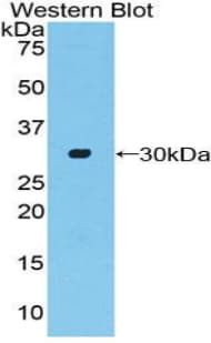 ADCY2 / Adenylate Cyclase 2 Antibody (aa294-525, Biotin)