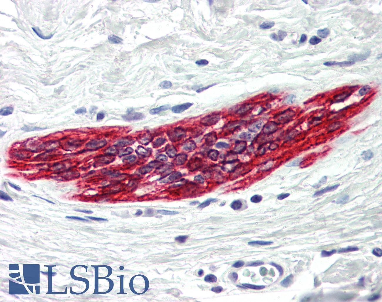 IHC-plus™ Polyclonal Rabbit anti-Human DAPK2 / DAP Kinase 2 Antibody (IHC, WB)