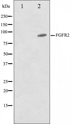 Polyclonal Rabbit anti-Human FGFR2 / FGF Receptor 2 Antibody (IHC, WB)