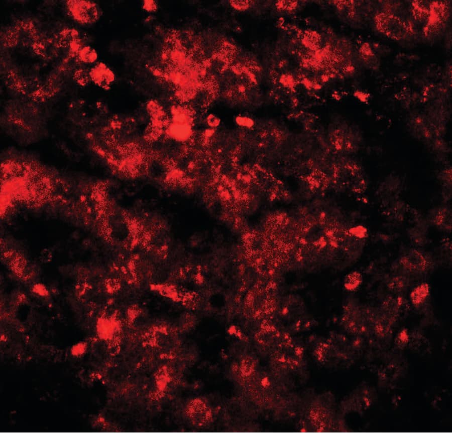 IHC-plus™ RNF20 Antibody