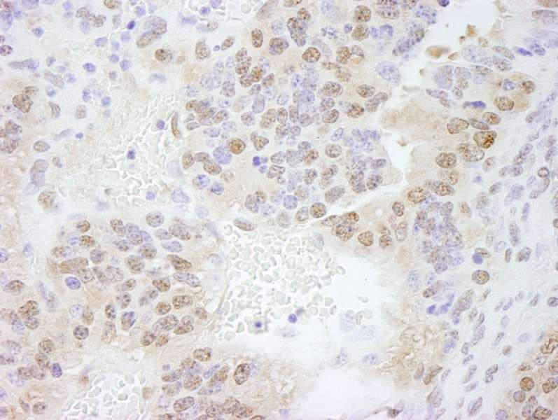 ERF / PE2 Antibody (aa498-548)