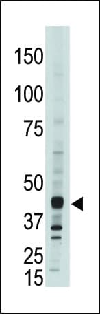 Polyclonal Rabbit anti-Human APOBEC3G / CEM15 Antibody (aa352-384, IHC, WB)