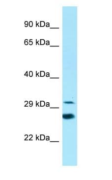 Polyclonal Rabbit anti-Human ELOVL6 Antibody (N-Terminus, WB)