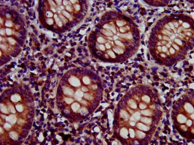 KIND2 / FERMT2 Antibody