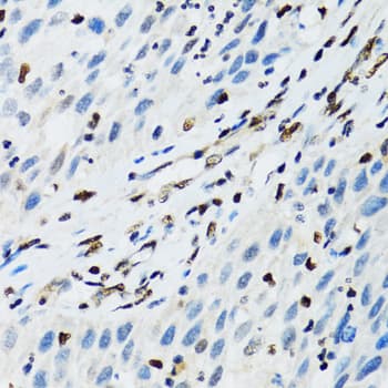 FLI1 Antibody
