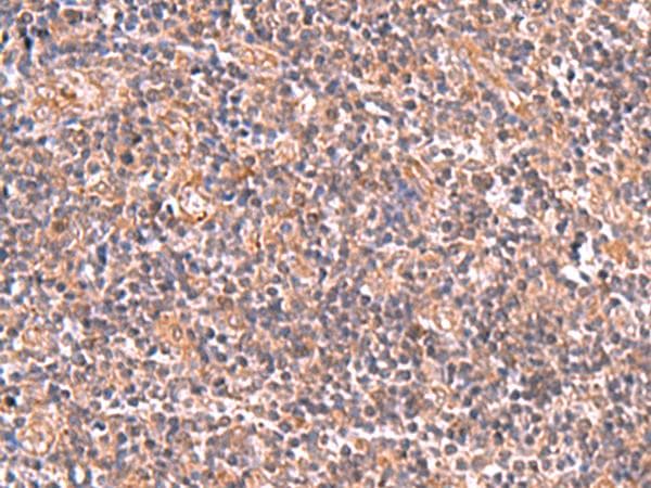 UBAC1 / KPC2 Antibody