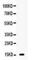 Gastric Inhibitory Peptide Antibody