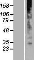 GOLT1B Protein (Over-Expression Lysate Myc-DDK (Flag))