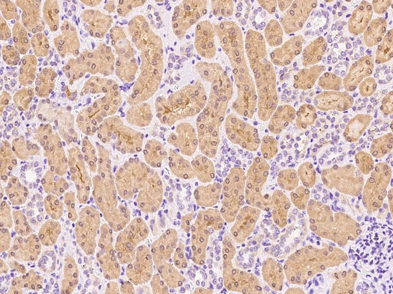 ALDH8A1 Antibody (Preservative Free)