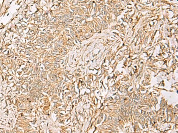 QDPR / DHPR Antibody